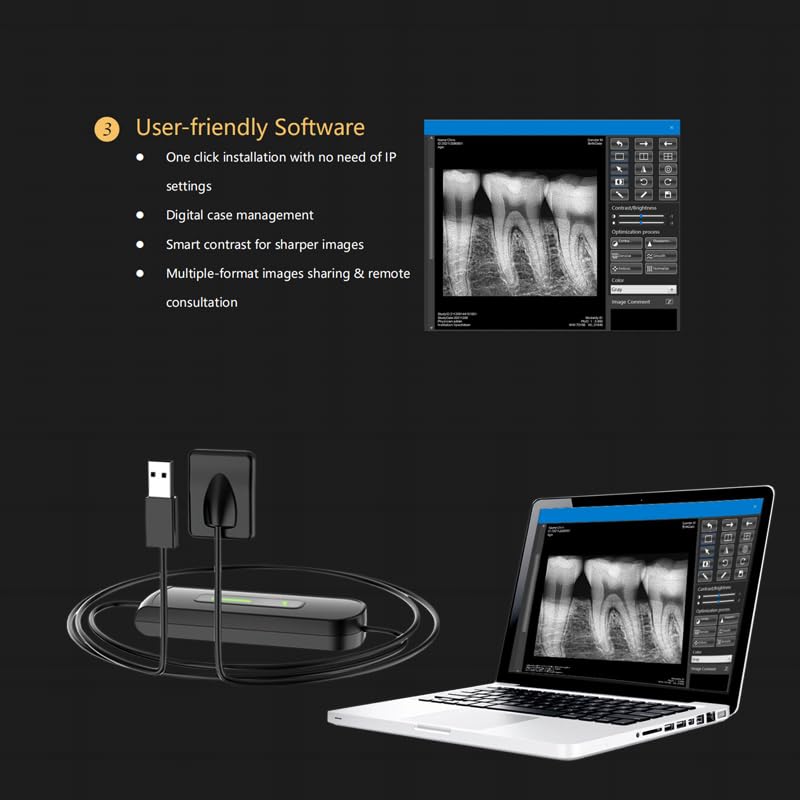 Dental X-Ray Sensor Veterinary Radiovisograph HD Digital Intraoral Imaging System Portable X Ray Digital Sensor (0.8 (21x21mm))
