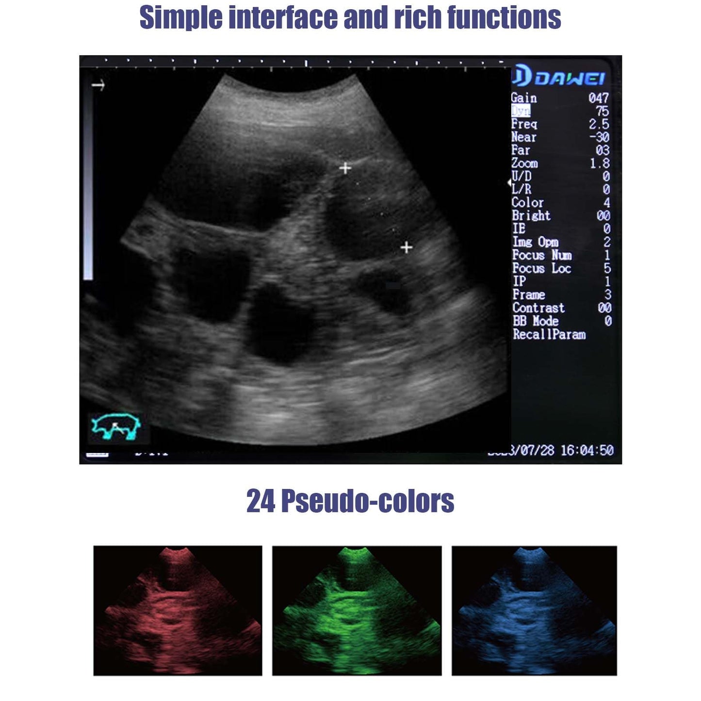 DAWEIanimed DAWEI Portable Ultrasound Machine Vet Ultrasound Scanner for Pregnancy with 3.5Mhz Rectal Convex Probe for Hoese,Cattle,Cow,Goat,Pig Livestock