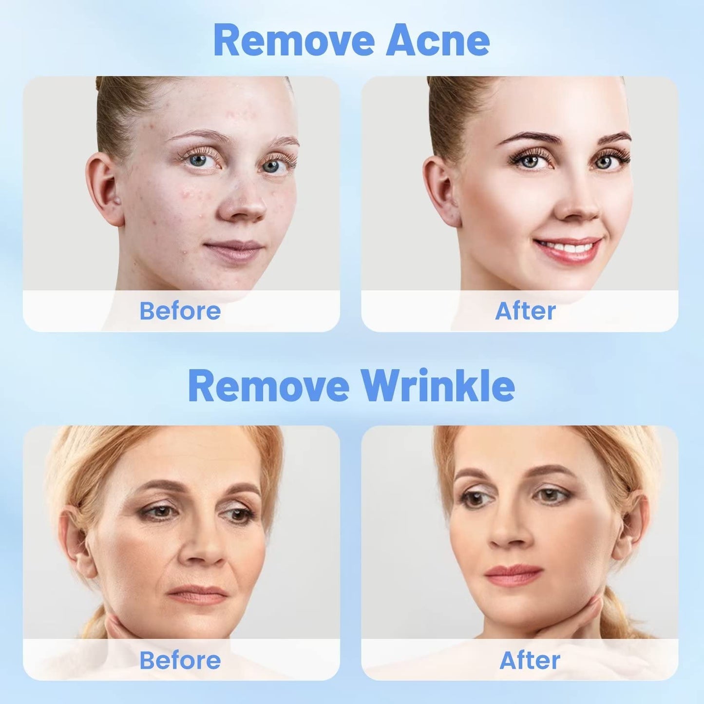 5 in 1 Micro Diamondermabrasion Machine, Mcwdoit Facial Machine 68cmhg Professional Home Use Skin Care