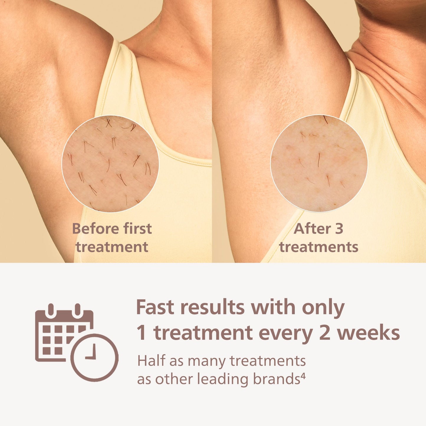 Philips Lumea 9000 Series IPL Hair Removal Device, Visible Permanent Laser Hair Reduction Done at Home, for Women & Men, SenseIQ Technology, 4 Attachments for Body, Face, Bikini & Underarms, BRI984/03