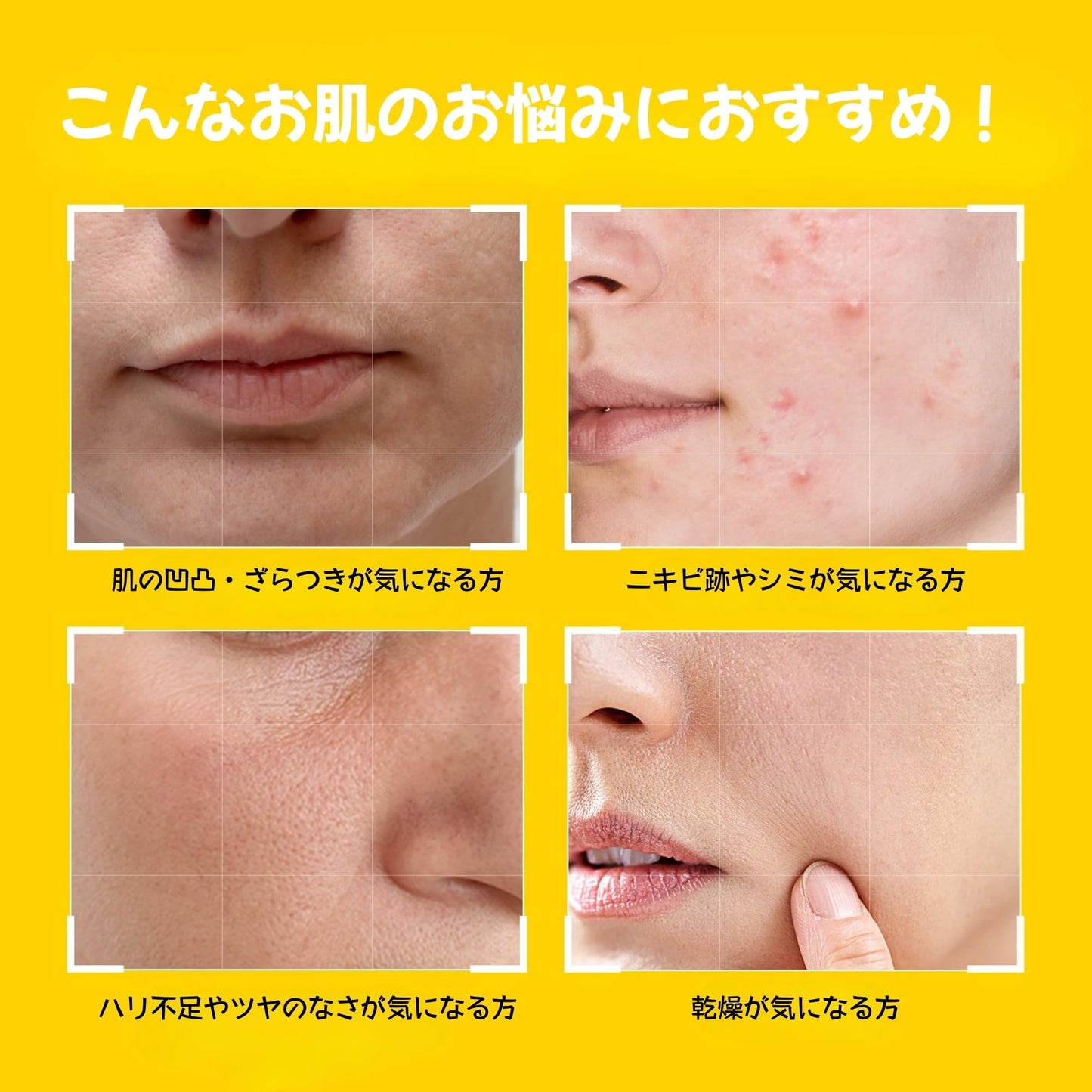 Boosting Toner Pads for Face Oily Skin Korean, #OOTD Vitamin C Niacinamide Heartleaf Hydrating Calming Redness, Vitamin C Toner Pad 70Pads 4.05oz 120ml