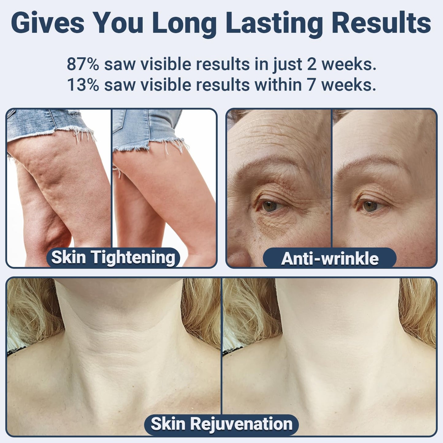 Radio Frequency Skin Tightening - TUMAKOU RF Radiofrecuencia Facial Skin Machine for Face and Full Body - with 3 Energy Levels & Timer