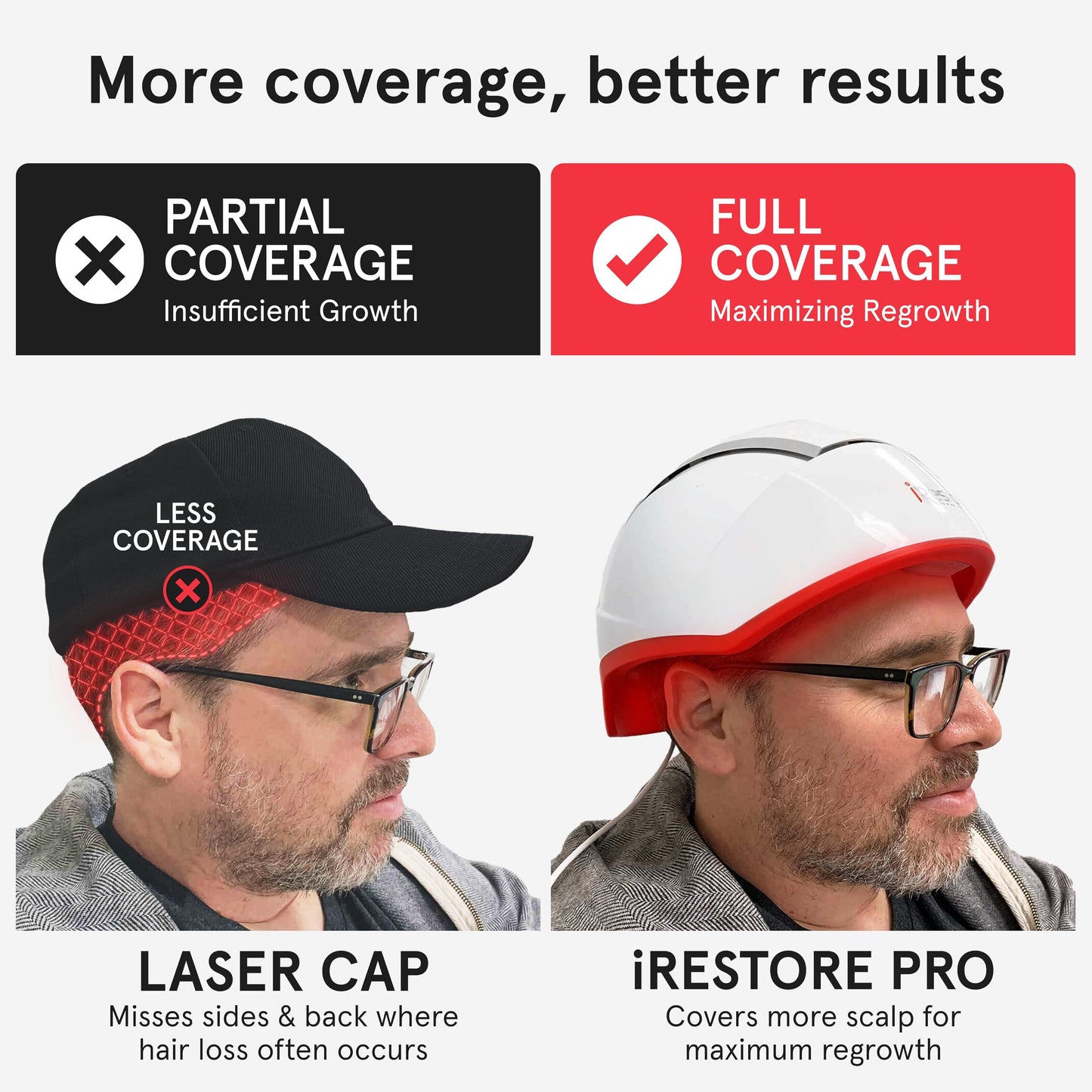 iRestore Professional Laser Red Light Therapy for Hair Growth System - FDA Cleared Hair Loss, Hair Thinning & Alopecia Treatment for Men & Women - 282 Lasers & LEDs