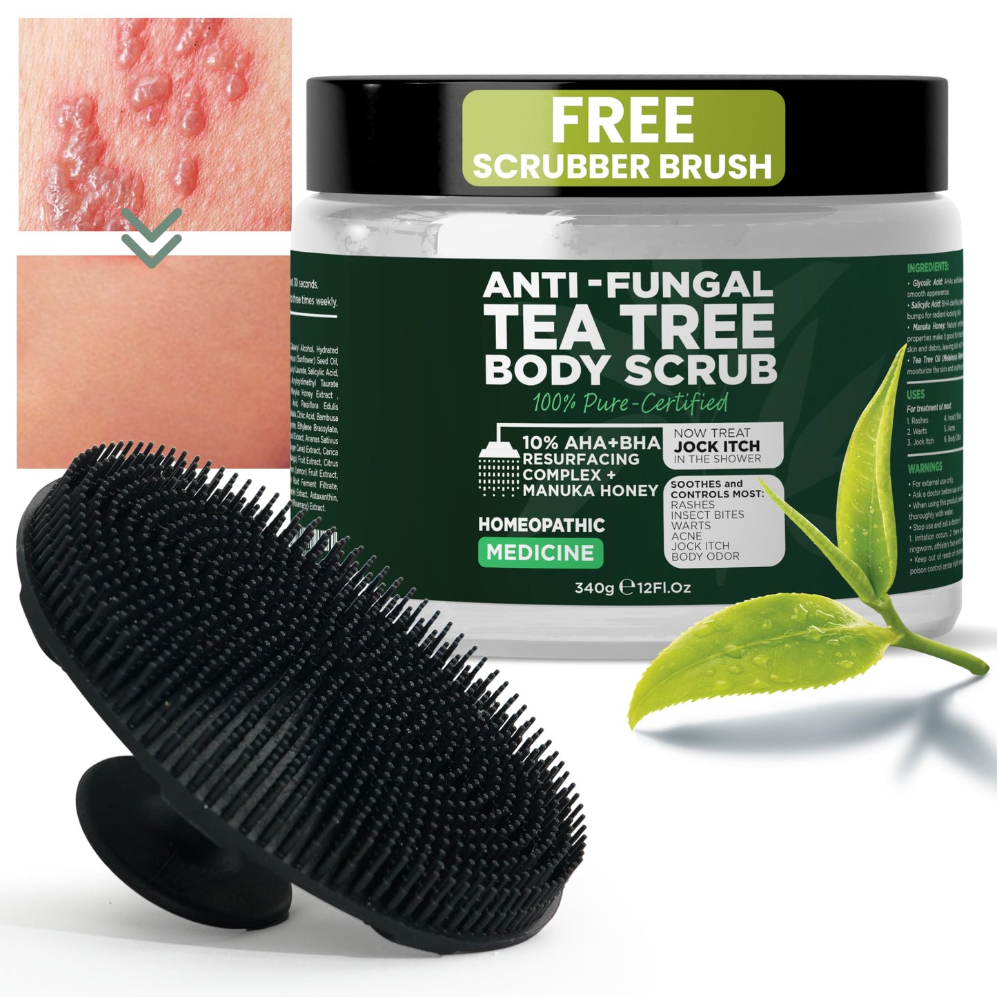Body Scrub | Tea Tree Oil Scrub with Manuka Honey and Salicylic Acid | Fights Jock Itch, Acne, Rashes & Body Odor | Anti Fungal Natural Body Exfoliator for Men and Women with Free Scrubber Brush